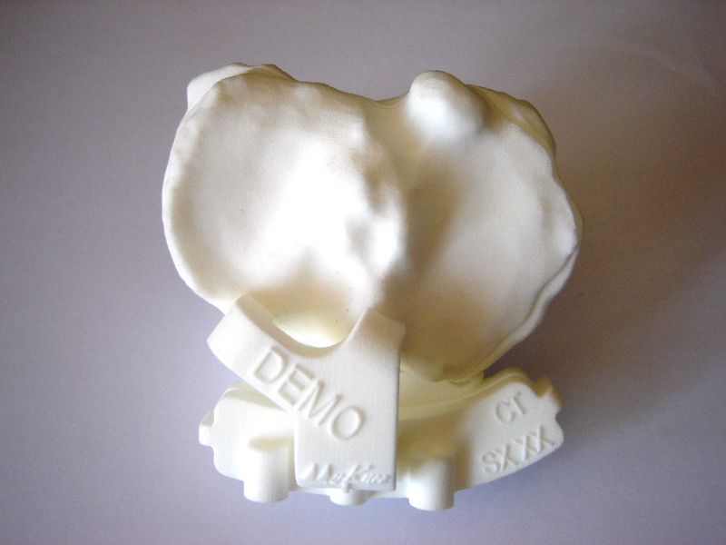 Top down view of tibial block mounted on tibial model